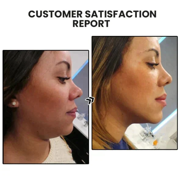 🔥𝐂𝐙𝐓𝐈𝐂𝐋𝐄® Lymphvity MagneTherapy Germanium Earrings💎 (Worn once a day, visible changes in 7 days) Support for obesity, diabetes, sleep apnea and joint problems 🍃 - Image 6
