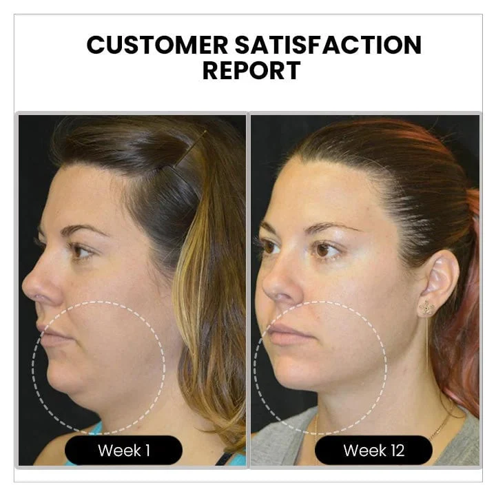🔥𝐂𝐙𝐓𝐈𝐂𝐋𝐄® Lymphvity MagneTherapy Germanium Earrings💎 (Worn once a day, visible changes in 7 days) Support for obesity, diabetes, sleep apnea and joint problems 🍃 - Image 8